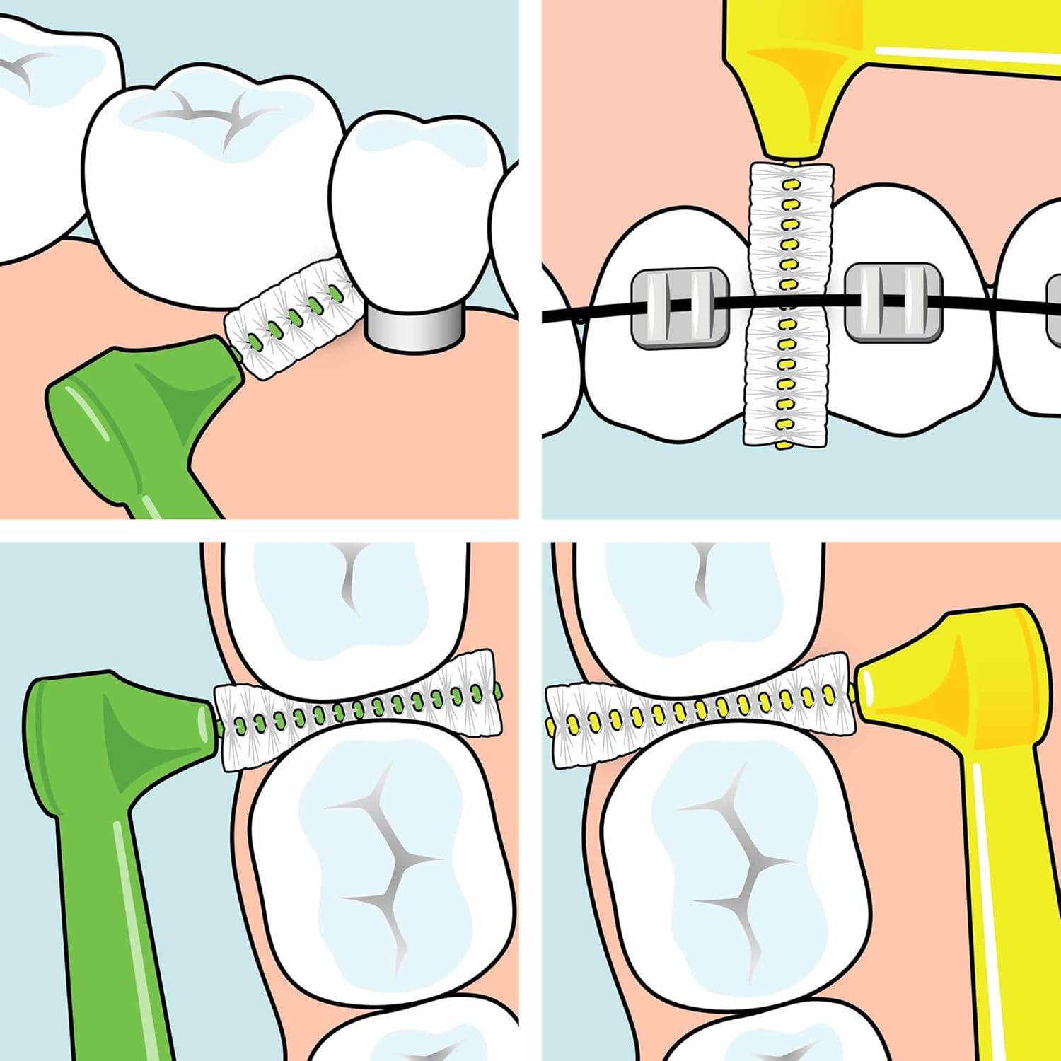 Tepe Angle Interdental Brush Mixed Set 6 pcs