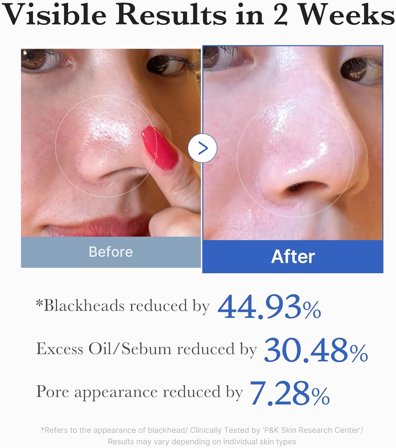 Medicube Zero Pore Pad 2.0 - 70 Pads