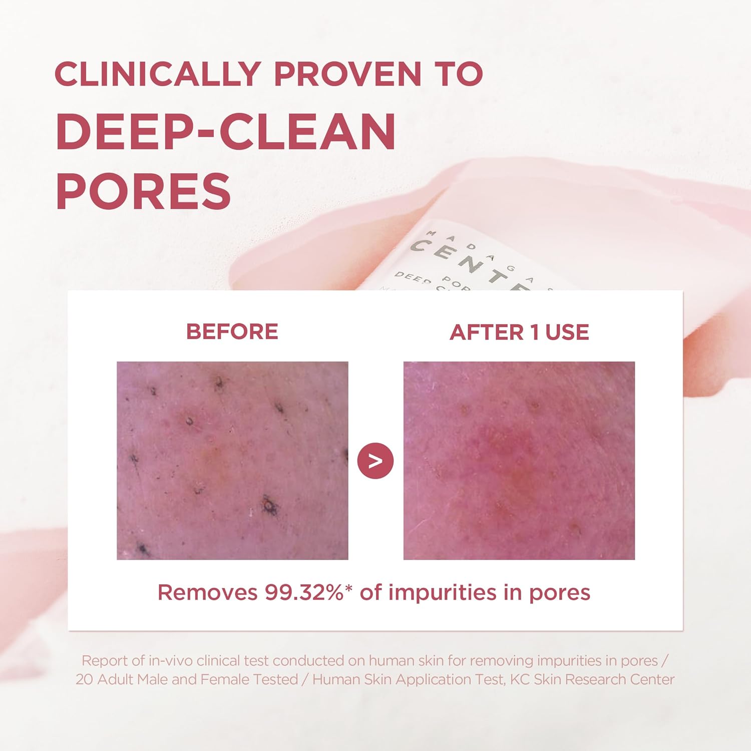 SKIN1004 Madagascar Centela Poremizing Deep Cleansing Foam - 125ml