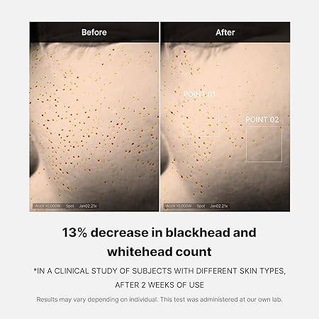 Medicube Zero Pore One Day Serum - 30ml